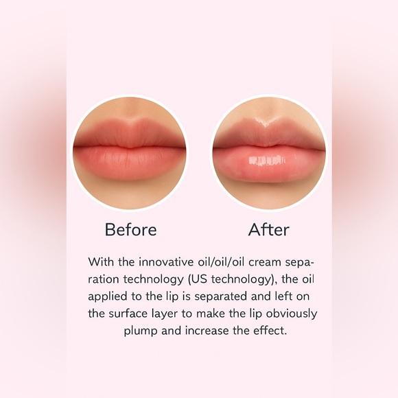 Lip Gloss Plumper – Lyne Beauty (Hyaluronic & SPF50) - Picture 12 of 12